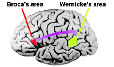 Broca's and Wernicke's area diagram